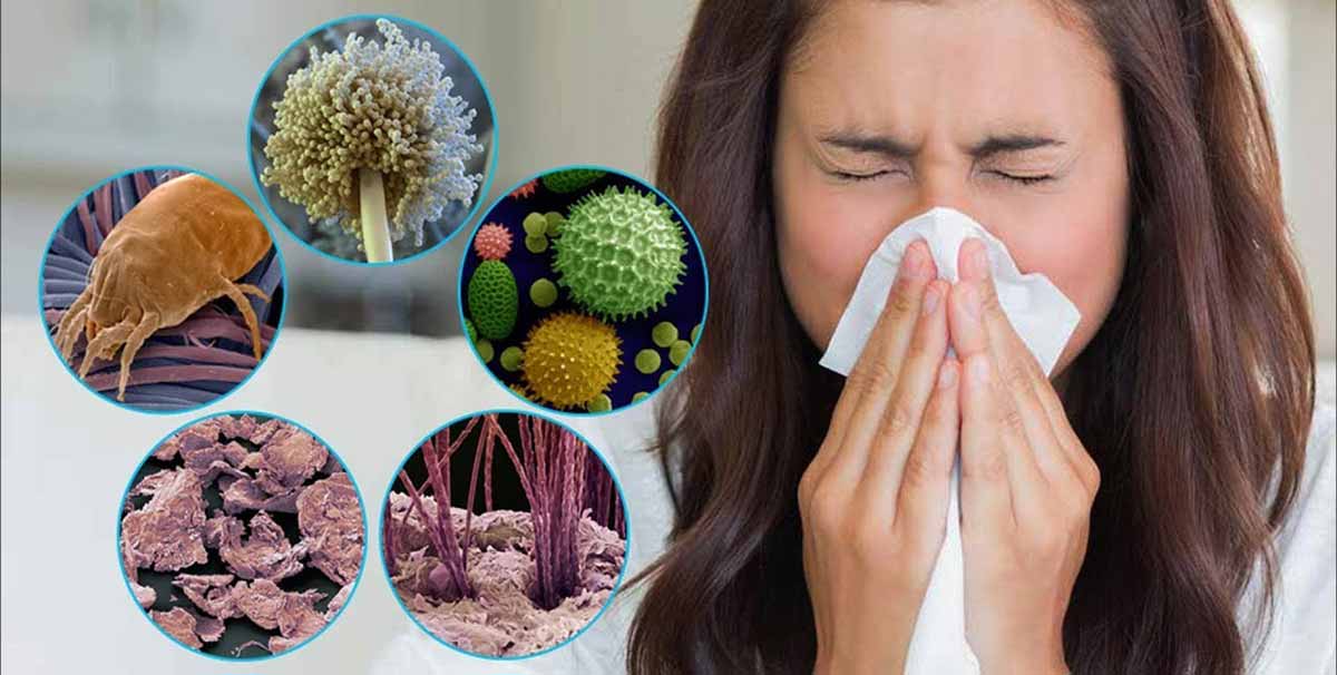 Allergologiya bo’limi