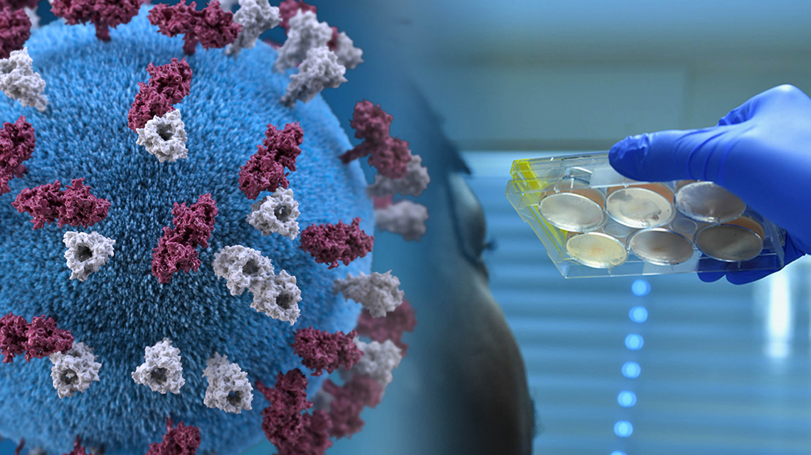 Kecha dunyo bo‘yicha 1 million nafardan ziyod kishida koronavirus infeksiyasi aniqlandi